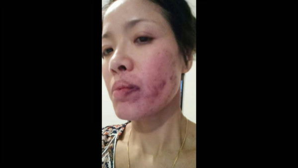 資深老戲骨驚爆被某女藝人掌摑至爆血管！恐怖傷勢曝光再點名澄清：關係非常良好