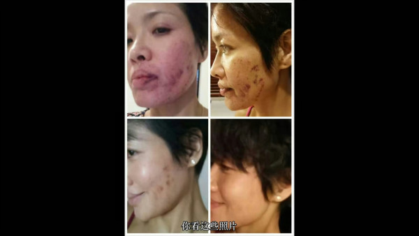 資深老戲骨驚爆被某女藝人掌摑至爆血管！恐怖傷勢曝光再點名澄清：關係非常良好