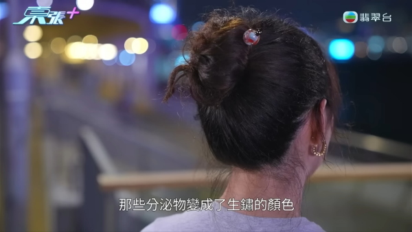 港女下體分泌物呈鏽色飄腐臭！陰道炎夾出黑血紗布球 驚揭公院婦科檢查恐怖真相