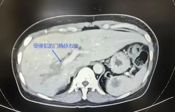 圖片來源：《羊城晚報》