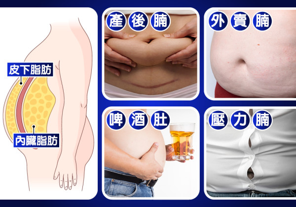 夏天自帶「水泡」超顯眼？拆解少食多運動肚腩依然跟身之謎！2個實驗挑機人氣「4D斷脂黑科技」！
