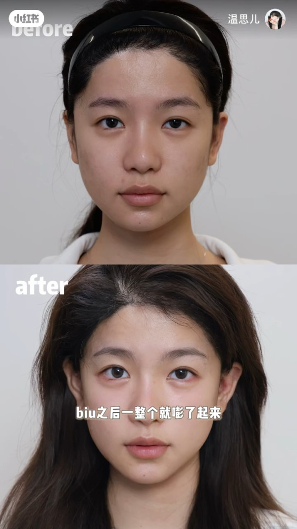 香港小姐2026｜蕃茄醬溫思婷舊照被挖疑似整容？黑歷史曝光改造兩大部位兼用假胸