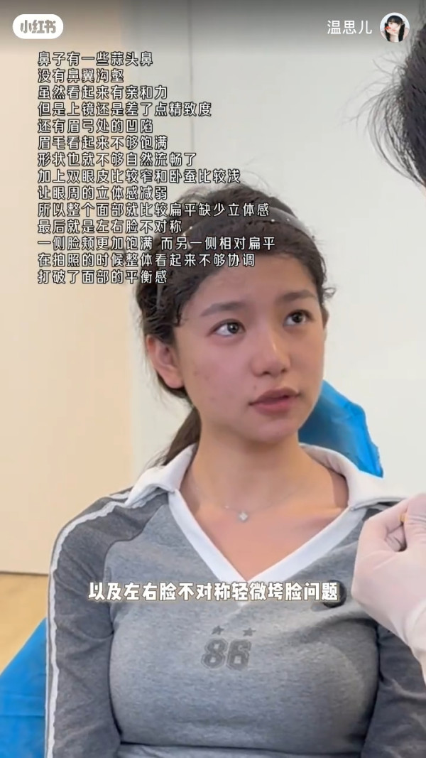 香港小姐2026｜蕃茄醬溫思婷舊照被挖疑似整容？黑歷史曝光改造兩大部位兼用假胸