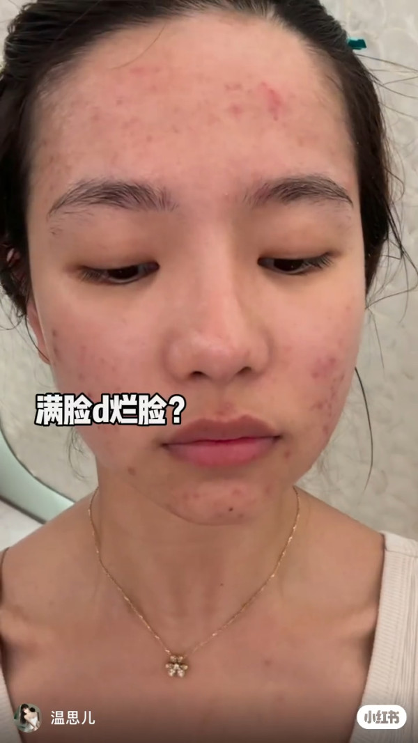 香港小姐2026｜蕃茄醬溫思婷舊照被挖疑似整容？黑歷史曝光改造兩大部位兼用假胸