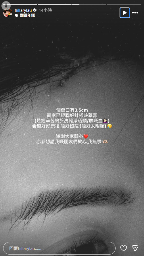 35歲女藝人驚傳突然受傷緊急送院！發生恐怖意外頭部爆缸：倒水式咁流出嚟