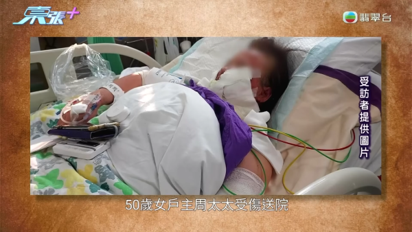 藍田邨廚房恐怖煤氣爆炸!女戶主四成皮膚燒傷「刮皮」淌血!命懸一線恐失工作能力