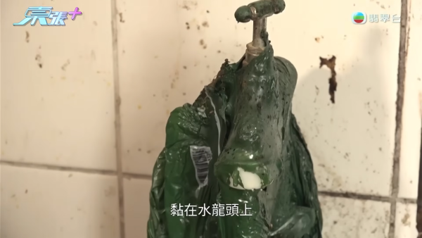藍田邨廚房恐怖煤氣爆炸！女戶主四成皮膚燒傷「刮皮」淌血！命懸一線恐失工作能力