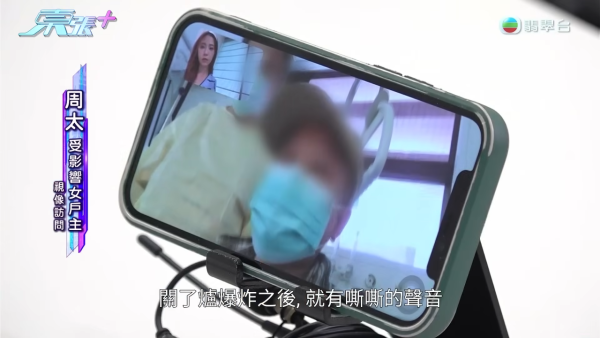 藍田邨廚房恐怖煤氣爆炸！女戶主四成皮膚燒傷「刮皮」淌血！命懸一線恐失工作能力