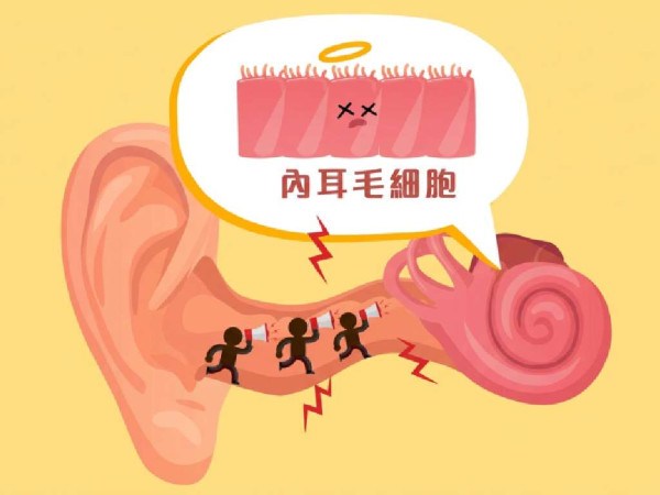 【恐怖科技病】晚晚戴耳機聽歌入睡終致耳聾！23 歲患者聽覺退化 50 年 醫生警告有這微小病況已出事