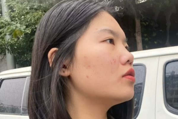 告別「虎背熊腰」!小紅書爆紅3招居家瘦背操 改善寒背重塑背部及面型線條