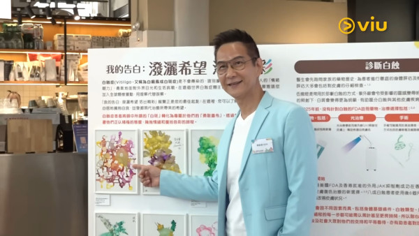 61岁前一哥惊爆患白癜风10年身心受尽煎熬！自揭陷入深度抑郁：差一点命都没了
