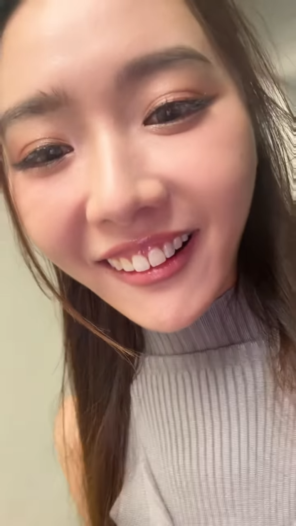 戴祖儀遭撞崩門牙痛到即時死掩嘴！兇手係呢位靚仔小生 一分手即許承諾負責任