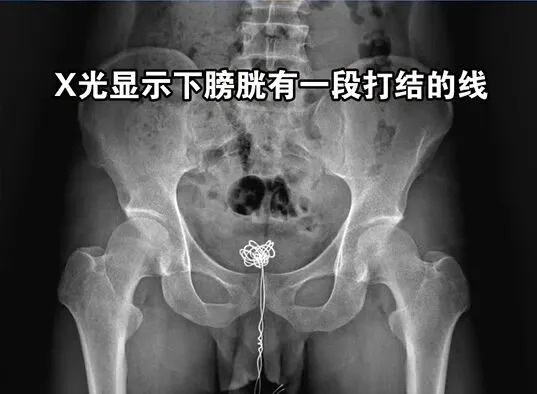 圖片來源：《南方都市報》