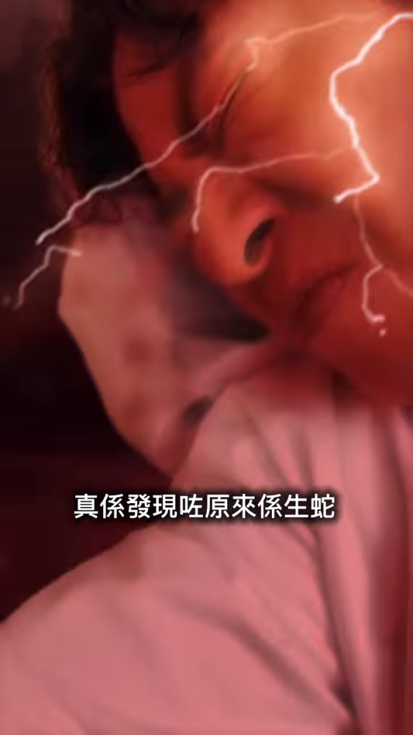 許廷鏗驚爆生蛇被迫停工抗病魔！術後失調左手大片瘀血痛到情緒崩潰