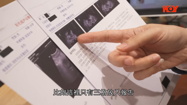 北上身體檢查$50起做到？68歲港男深圳照超聲波即日有報告！港醫拆解一原因須重驗