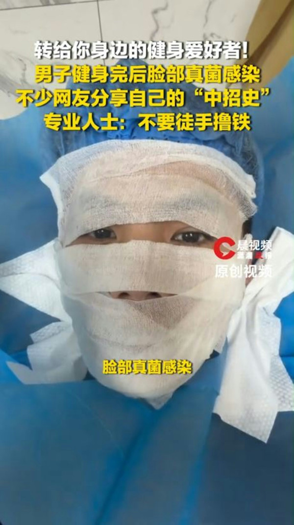 做gym用手抹汗致香港腳上臉！健身室器械真菌超標／中醫推介2大去濕抗菌湯水及外洗方