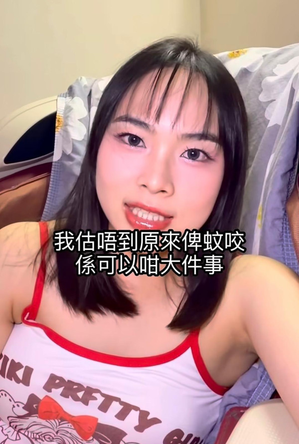 抓破蚊爛隨時喪命？港女染蜂窩組織炎行唔到 醫生揭2類人極高危促即求醫
