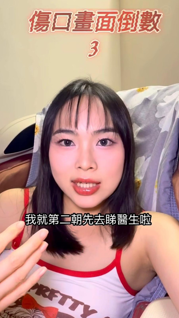 抓破蚊爛隨時喪命？港女染蜂窩組織炎行唔到 醫生揭2類人極高危促即求醫