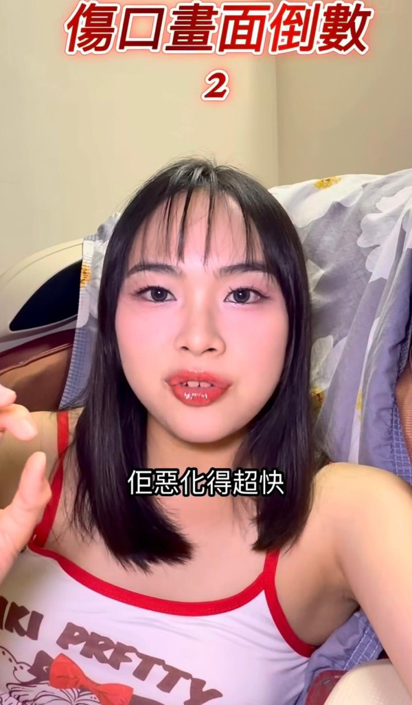 抓破蚊爛隨時喪命？港女染蜂窩組織炎行唔到 醫生揭2類人極高危促即求醫