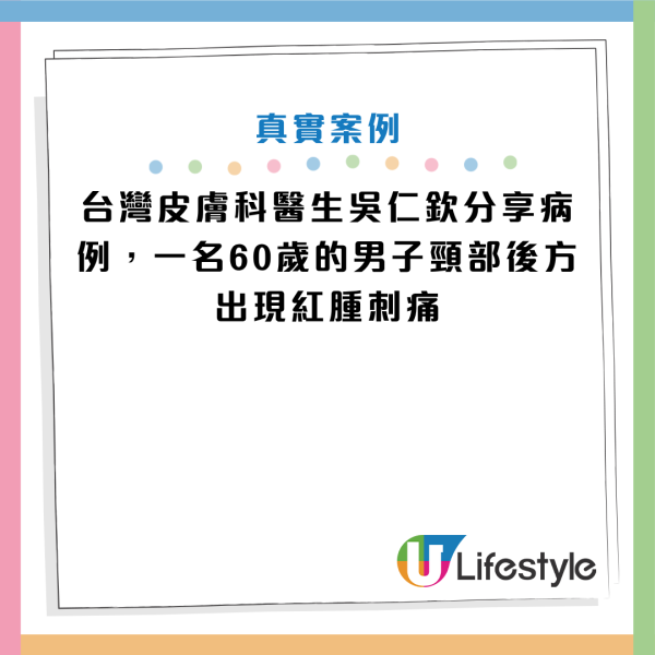 夏天常见隐翅虫别乱拍！男子误拍后皮肤遭强酸腐蚀 名医教路用这招保命