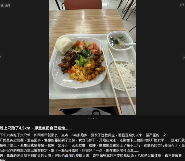 海鮮禁忌｜食完蝦去做Gym險送命！30歲女全身出疹兼「大脷」 醫生警告：食海鮮後6小時內千祈咪做呢件事！