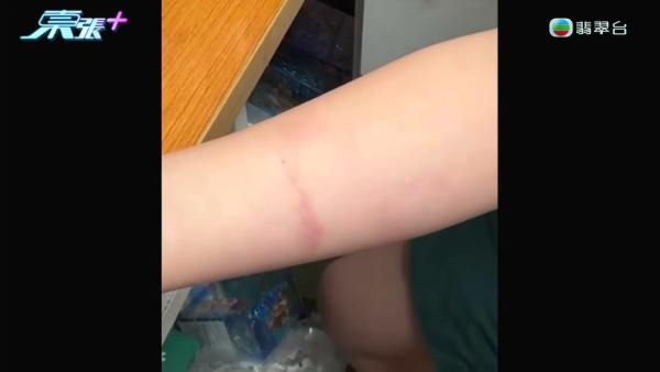 將軍澳小學老師疑帶頭欺凌SEN學生！煽動全班孤立錄音證據被刪 涉事王老師反應令人心寒
