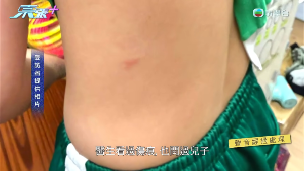 將軍澳小學老師疑帶頭欺凌SEN學生!煽動全班孤立錄音證據被刪 涉事王老師反應令人心寒