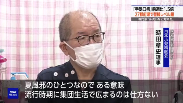 日本手足口病疫情再度升溫!一周破1.5萬宗個案 東京、奈良等27都府縣拉警報