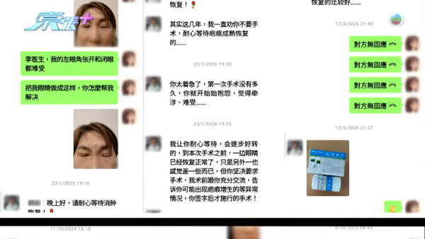 港女深圳醫美修復雙眼皮驚變噩夢！眼角夾出一物慘受折磨兩年 恐怖後果極駭人