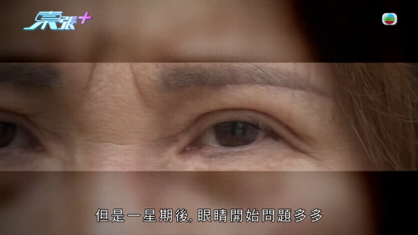 港女深圳醫美修復雙眼皮驚變噩夢！眼角夾出一物慘受折磨兩年 恐怖後果極駭人