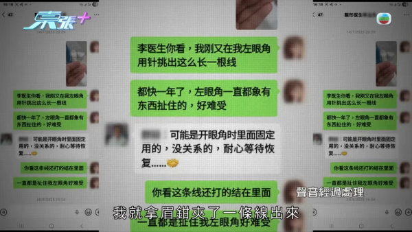 港女深圳醫美修復雙眼皮驚變噩夢！眼角夾出一物慘受折磨兩年 恐怖後果極駭人