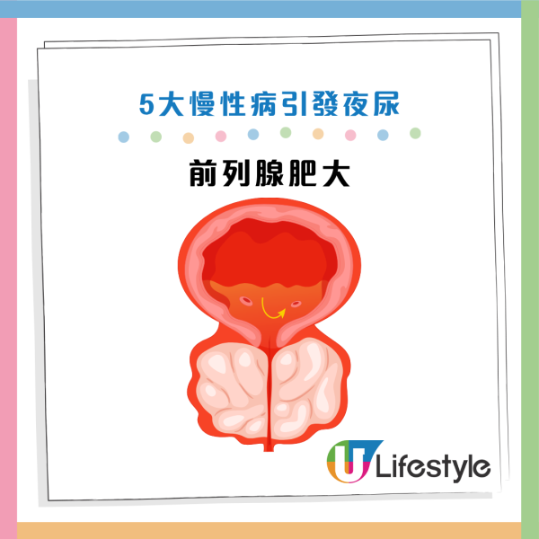 圖片資料來源：Facebook@穩紮穩打 輝達泌尿科院長 張英傑醫師 台中彰化南投 攝護腺包皮槍性功能障礙推薦