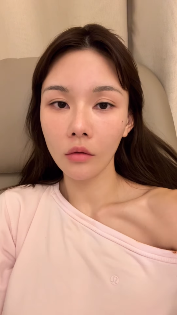 五索驚爆服安眠藥後嚴重受傷胸部重創 崩潰發聲：係一個好大嘅創傷