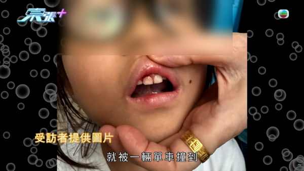 荃湾海滨童党横行无忌！飙“子弹仔”连环袭击长者兼撞飞女童送院 警拘4男童