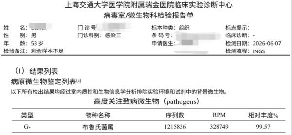 內地男徒手切生肉染「布魯氏菌」細菌侵蝕頸椎骨滲穿大洞 醫生揭廚房三大禁忌