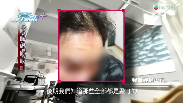 李旻芳為正義發聲對質護老院職員！狂爆金句撕破「虐老」謊言：佢識行就已經走咗啦