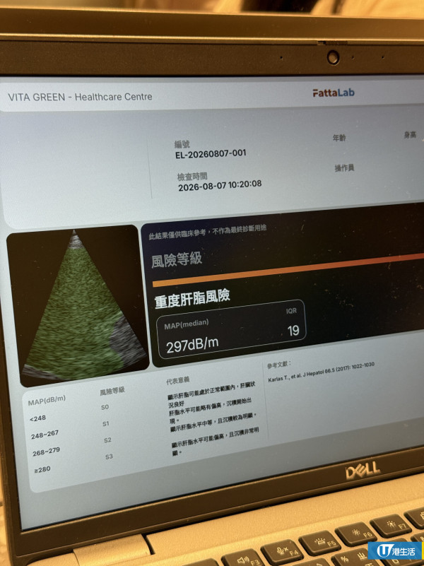 維特健靈免費肝臟健康掃描！30秒分析肝臟脂肪＋限時免費送皇牌健康產品