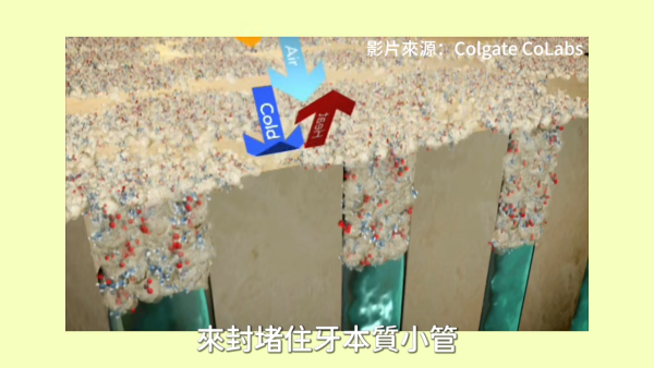 敏感牙齒｜抗敏感牙膏刷極都無用？牙醫揭一常犯盲點 2類牙膏大不同 教一招即時見效！