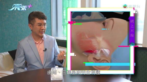 港女赴深圳拉皮惨变毁容级包包面!恐怖疤痕增生兼狂掉头发 涉假病历院长嚣张寸爆