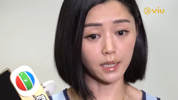 衛詩雅親身還原嘴唇割傷恐怖瞬間！伸脷舔驚覺裂開失去知覺：唔敢睇個傷口