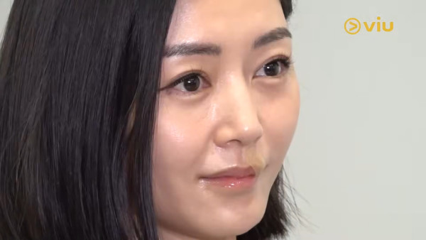 衛詩雅親身還原嘴唇割傷恐怖瞬間！伸脷舔驚覺裂開失去知覺：唔敢睇個傷口