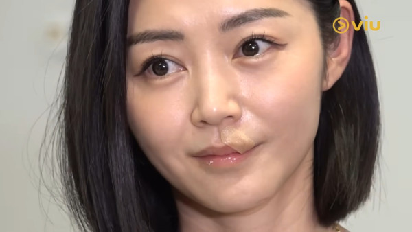 衛詩雅親身還原嘴唇割傷恐怖瞬間！伸脷舔驚覺裂開失去知覺：唔敢睇個傷口