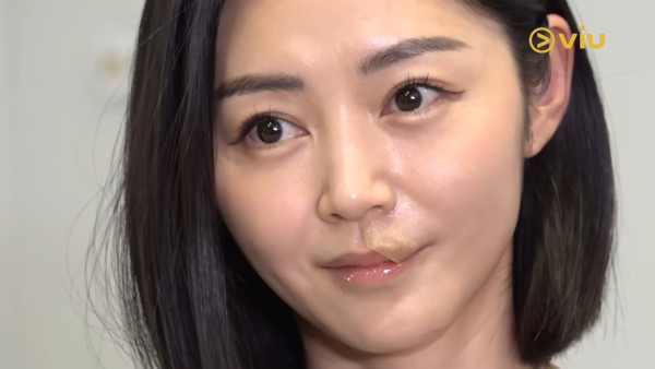 衛詩雅親身還原嘴唇割傷恐怖瞬間！伸脷舔驚覺裂開失去知覺：唔敢睇個傷口