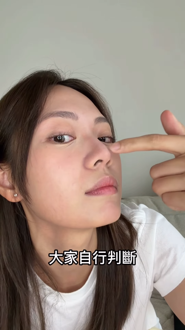游嘉欣震撼公开8年“整容史”承认进化！被指隆鼻削骨整微笑唇 即时揉鼻捏下颚线