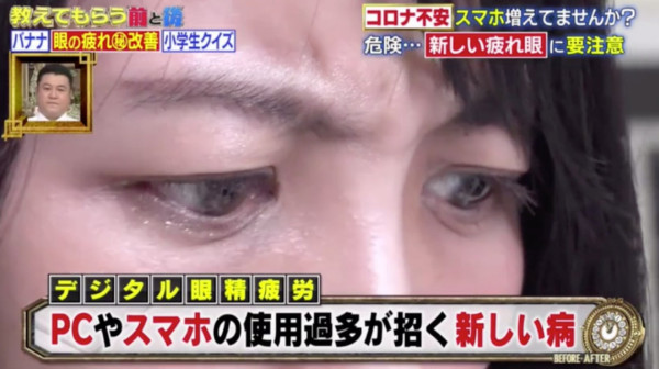 日本眼科醫生1秒閃光燈驗眼術！影相冇紅眼＝過勞？醫生3招改善＋護眼食譜