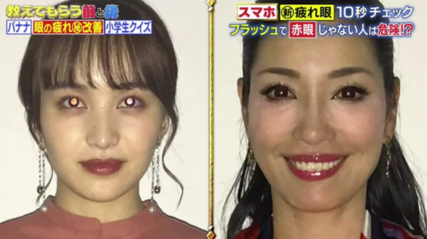 日本眼科醫生1秒閃光燈驗眼術！影相冇紅眼＝過勞？醫生3招改善＋護眼食譜