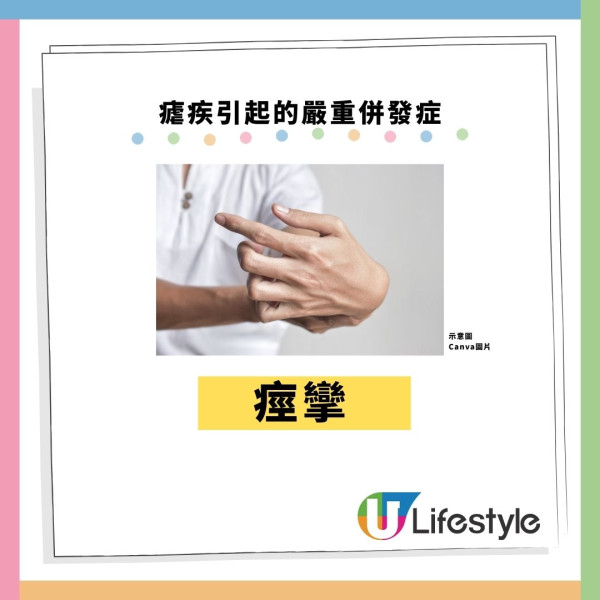 机场爆发罕见疟疾2死!毒蚊客舱偷渡入境 揭5大高危病征+6招防蚊方法