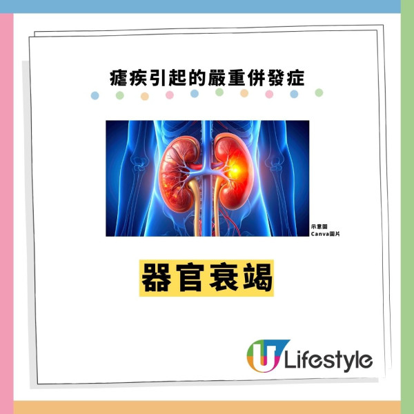 机场爆发罕见疟疾2死!毒蚊客舱偷渡入境 揭5大高危病征+6招防蚊方法
