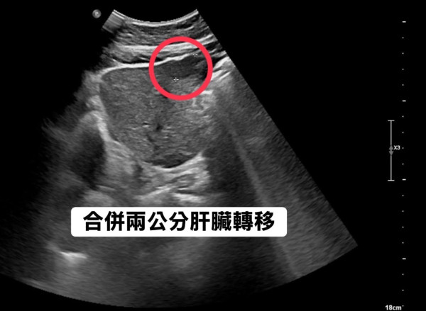 圖片來源：Facebook@胰臟醫師 林相宏 禾馨民權內科診所