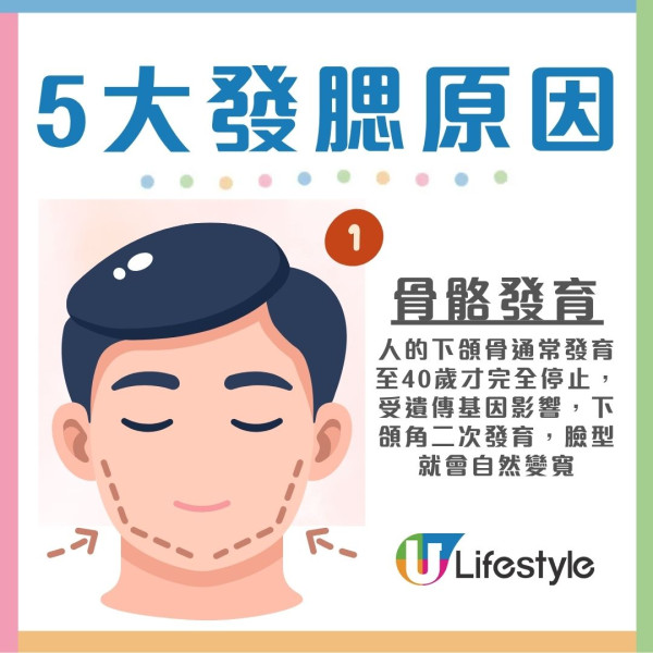 發腮解決︱年紀大臉變寬變方?日本專家教1招逆轉國字臉 附5大發腮原因解決方法
